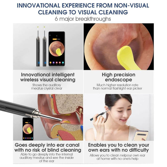 Wireless Ear Wax Removal Tool Kit with HD Camera – 1296P Otoscope Ear Cleaner with 6 LED Lights, 5MP Lens, 3.5mm Ear Scope, IP67 Waterproof, WiFi Compatible with iOS & Android
